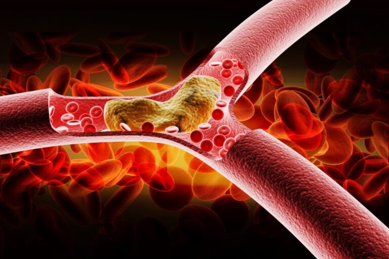sociedades-americanas-de-cardiologia-atualizam-diretrizes-para-controle-do-colesterol